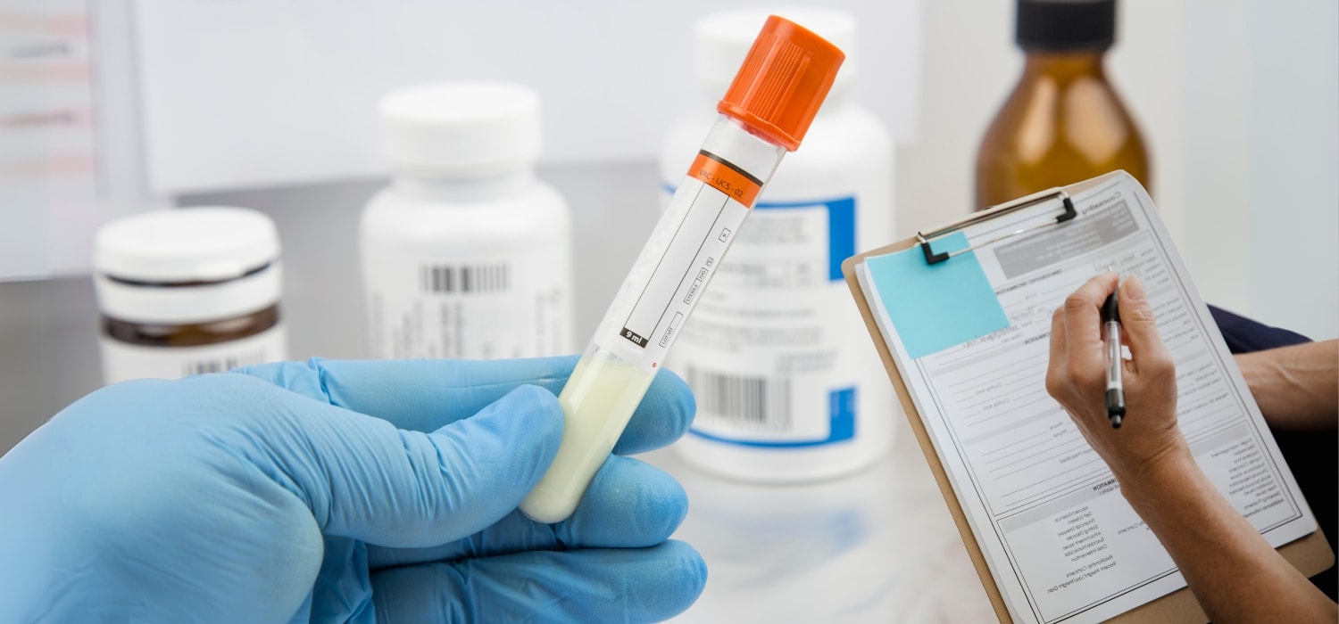 sperm test results explained