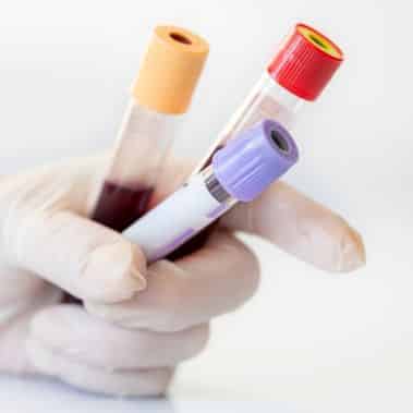 blood-tests hertility at home blood test
