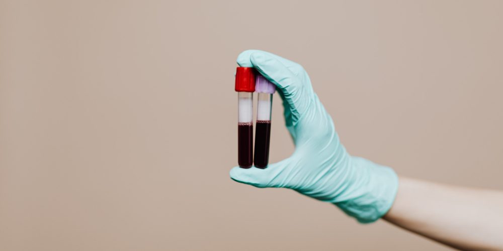 sperm donor genetic screening sperm donor genetic screening