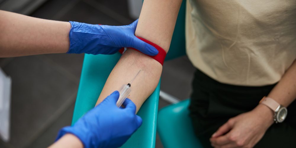 ovarian reserve test london