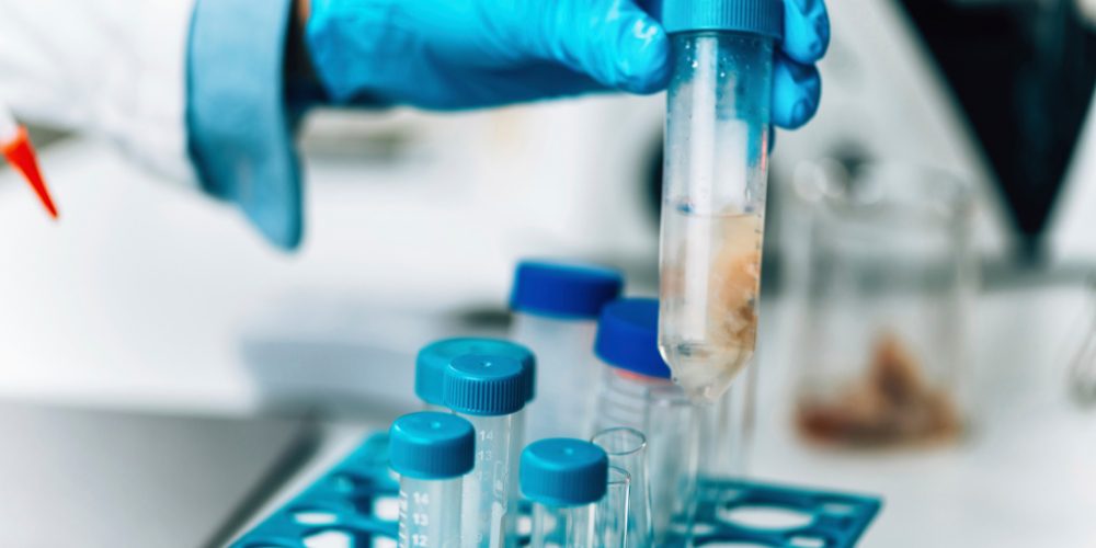 normal male fertility test results​