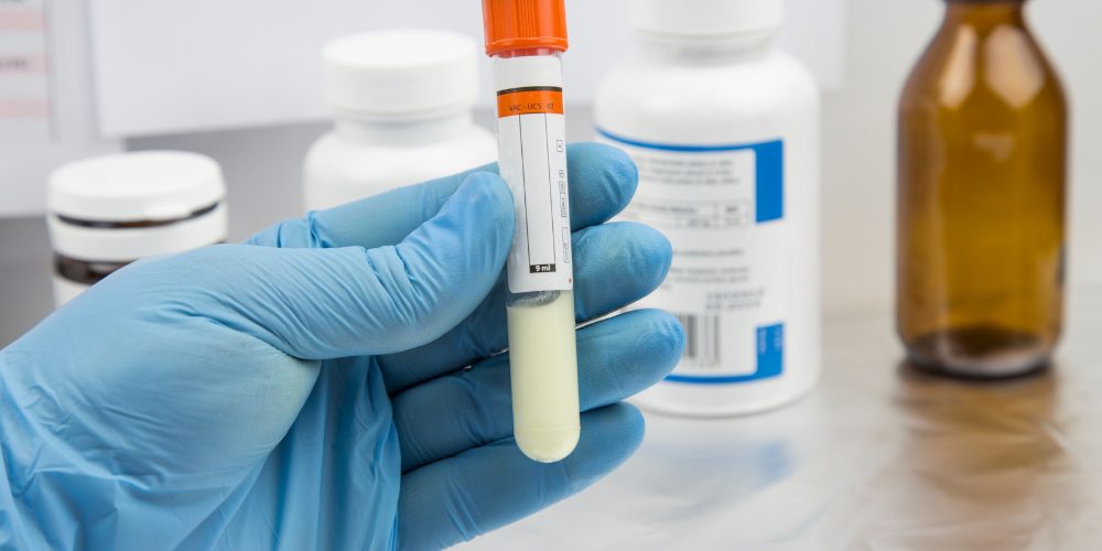 how to get pregnant with poor sperm morphology how to get pregnant with poor sperm morphology