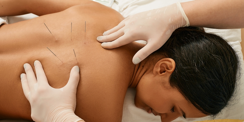 Can acupuncture help during early pregnancy Can acupuncture help during early pregnancy