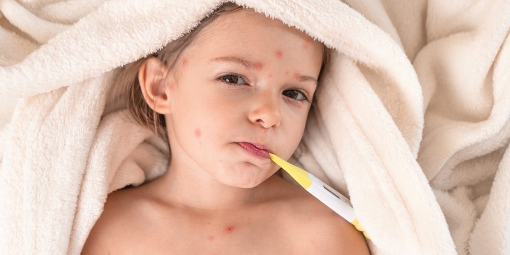 can you contract chicken pox twice
