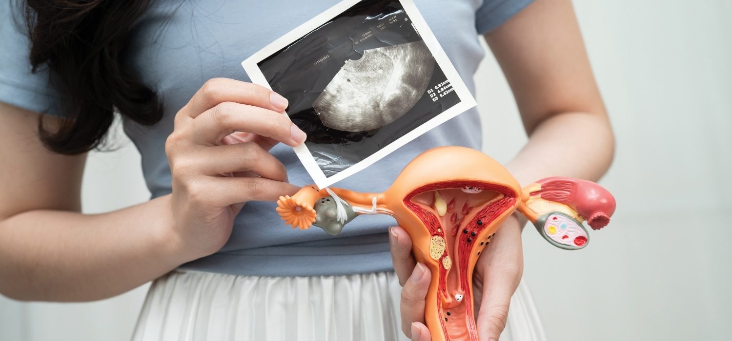 septate uterus with pregnancy